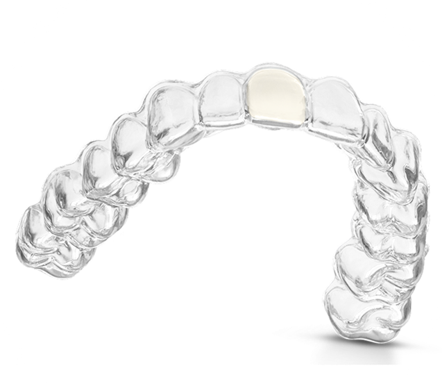 Hawley Retainer